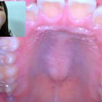 【HD】街角で声をかけて口内観察させてもらう アパレル関係 ひなみちゃん